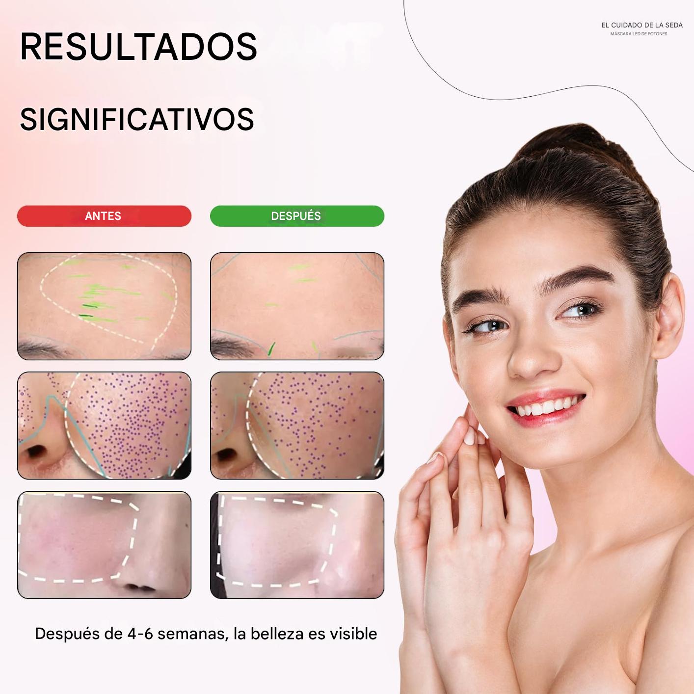 Máscara facial LED Terapia de luz roja avanzada para el cuidado facial Silkcare